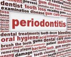 photo_dental_-_text_periodontitis