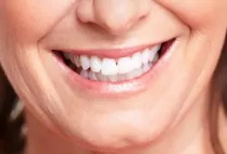 photo_dental_-_beautiful_smile_from_implants_2-6-13