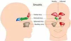 photo_dental_sinus