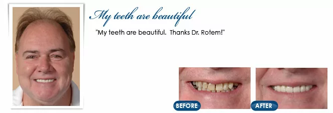 Toms River dentist Dr. Ronen Rotem, DDS, patient photos