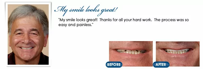 Restorative dentistry patient in Stafford Township, NJ patient photo