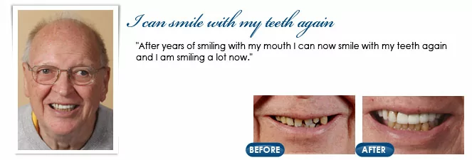 Dr. Ronen Rotem, DDS patient before and after photos