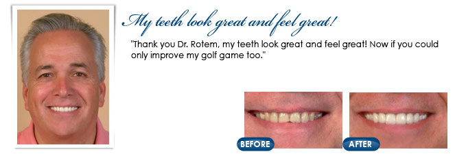 Cosmetic dentistry patient in Stafford Township, NJ patient photo