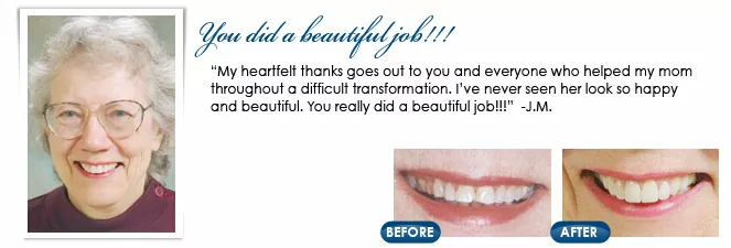 Toms River dentist before and after photos