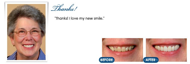 Cosmetic dentistry patient in Manchester Township, NJ patient photo