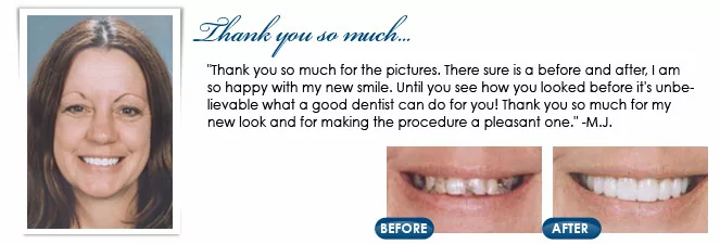 Brick, NJ dentist before and after photos