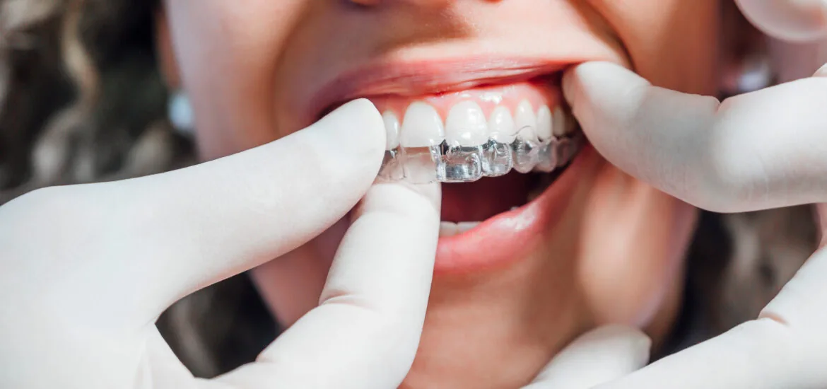 doctor fitting a young woman's clear aligners at Rotem Dental Care