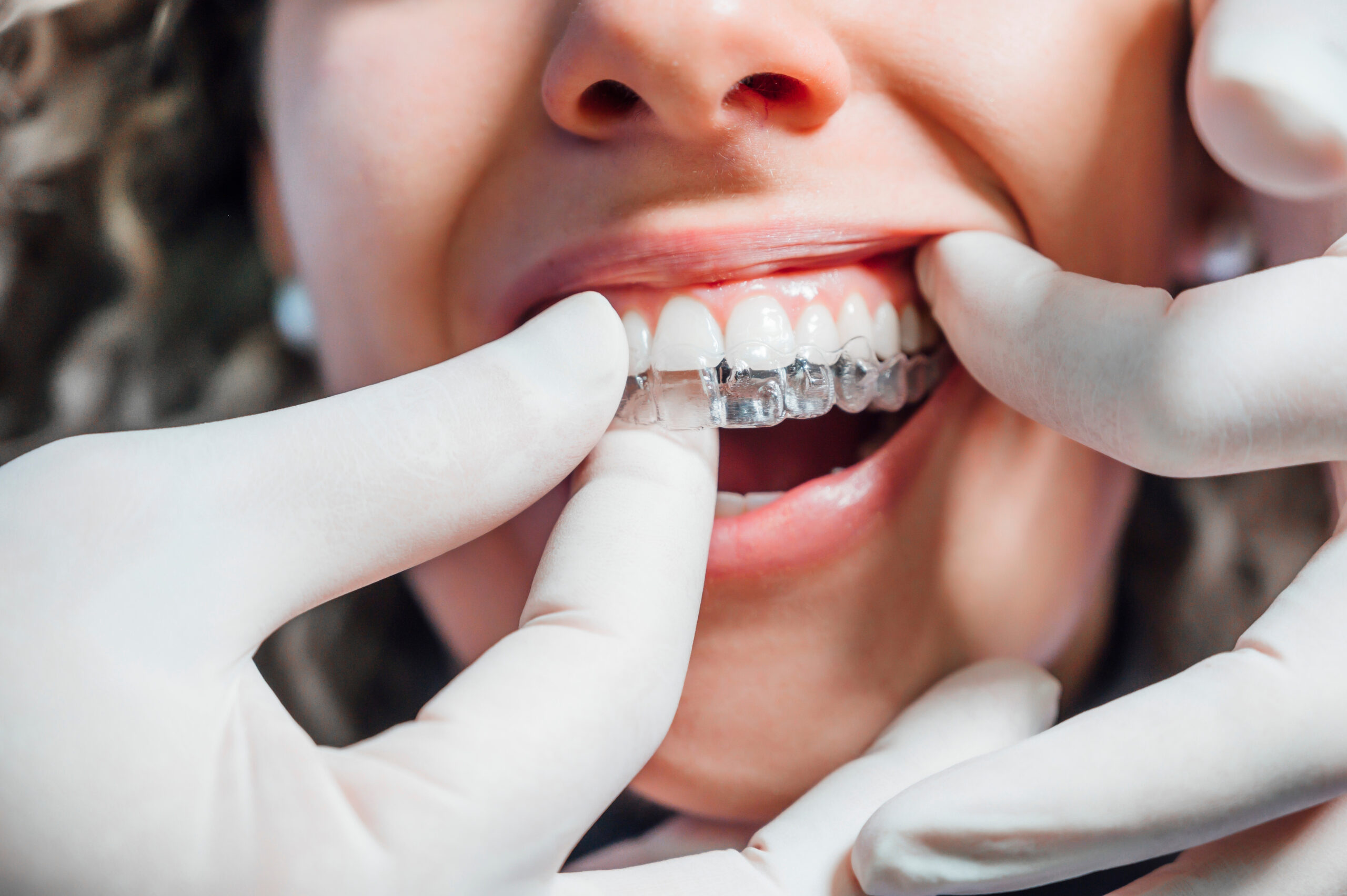 doctor fitting a young woman's clear aligners at Rotem Dental Care