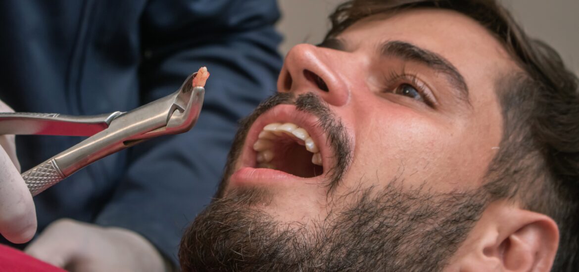 man having a tooth pulled by a dentist in Toms River