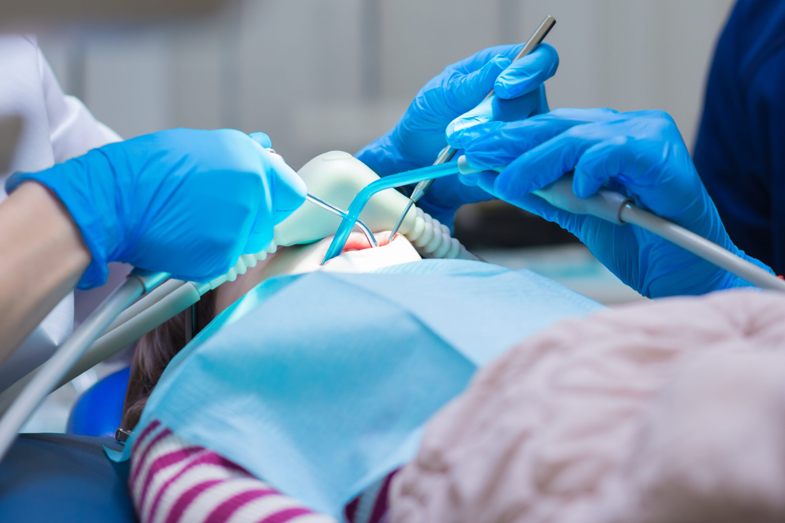 dentist in blue gloves using sedation during a dental procedure