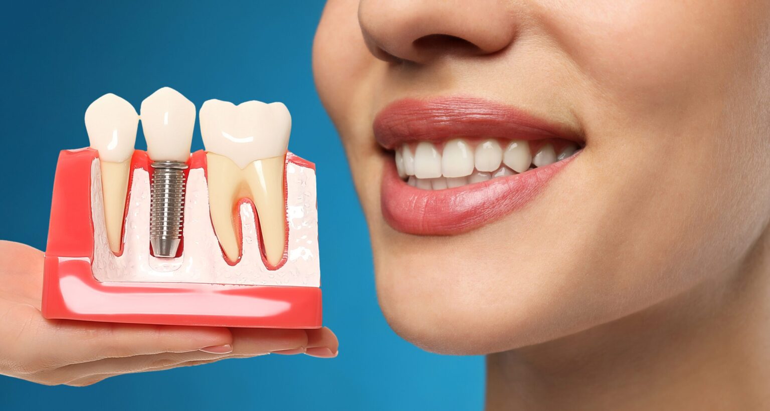 Young woman with beautiful smile and dentist holding educational model of dental implant on blue background,