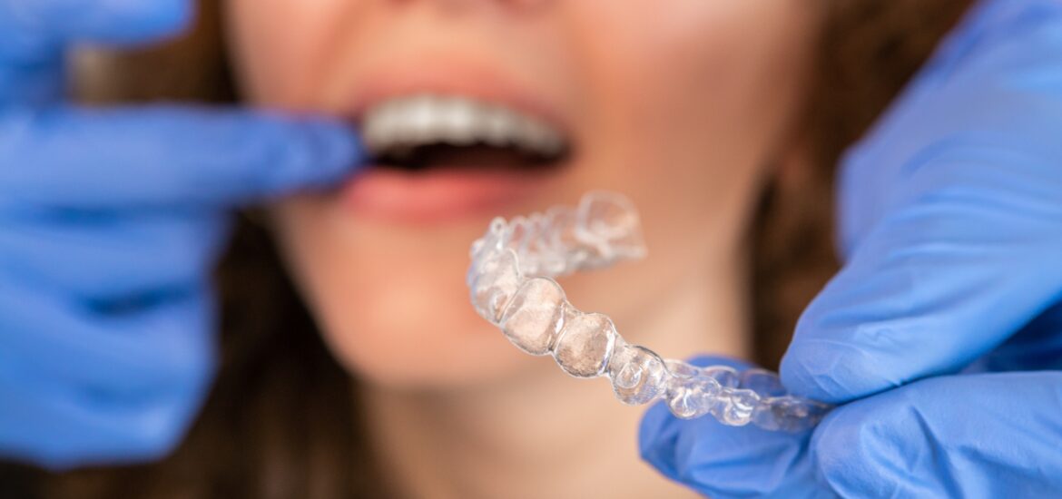 doctor in gloves puttting in clear aligners, closeup mouth view