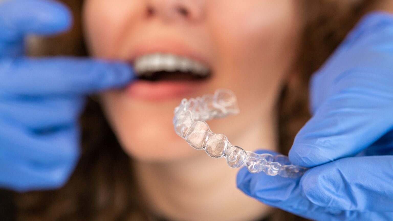 doctor in gloves puttting in clear aligners, closeup mouth view