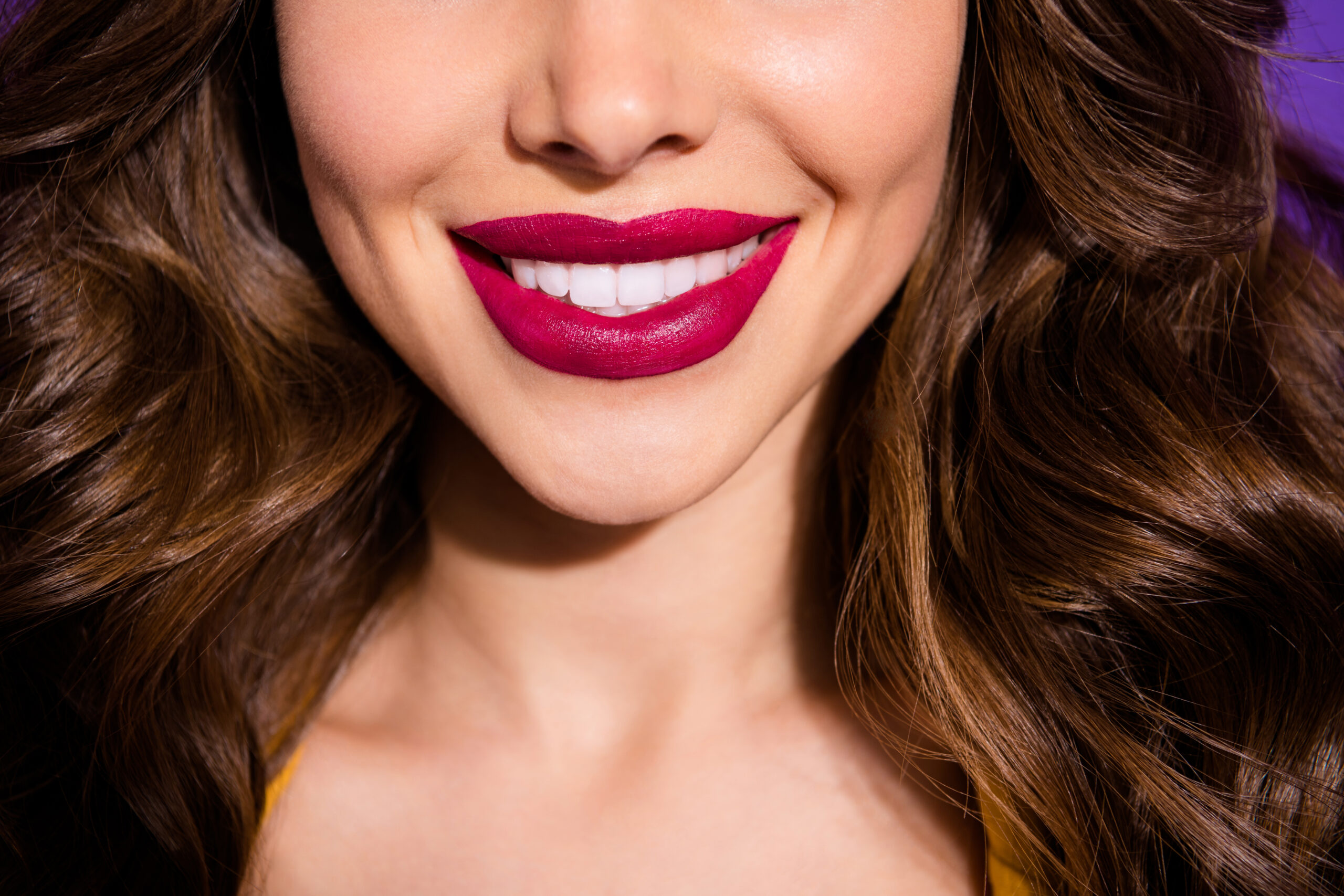 closeup view of a woman's new veneers